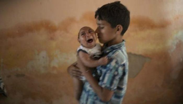 'झिका' वायरसनं ब्राझिलमध्ये जन्मतायत छोट्या डोक्याची बाळं! 'झिका' वायरसनं ब्राझिलमध्ये जन्मतायत छोट्या डोक्याची बाळं!