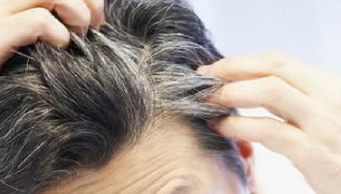 केस पांढरे होऊ नयेत म्हणून आहार केस पांढरे होऊ नयेत म्हणून आहार