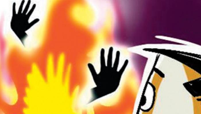 नोकरीवरुन काढून टाकले म्हणून महिलेने स्वत:ला घेतले जाळून नोकरीवरुन काढून टाकले म्हणून महिलेने स्वत:ला घेतले जाळून