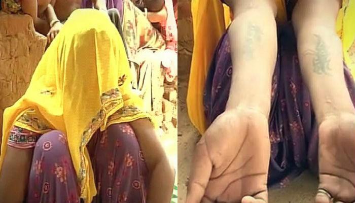हुंडा दिला नाही म्हणून केला गँगरेप, डोक्यावर लिहीलं मेरा बाप चोर है हुंडा दिला नाही म्हणून केला गँगरेप, डोक्यावर लिहीलं मेरा बाप चोर है