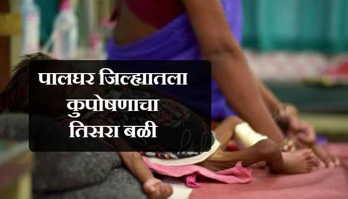 कुपोषणामुळे दोन वर्षांच्या चिमुरडीचा बळी कुपोषणामुळे दोन वर्षांच्या चिमुरडीचा बळी