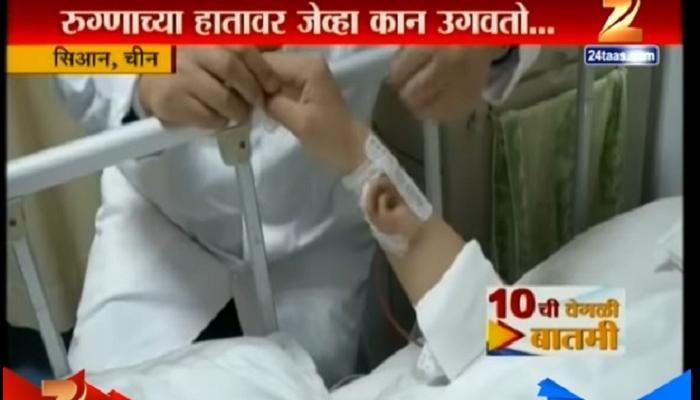 चमत्कार, हाडामासापासून तयार झालेला कृत्रिम कान जोडणार चमत्कार, हाडामासापासून तयार झालेला कृत्रिम कान जोडणार