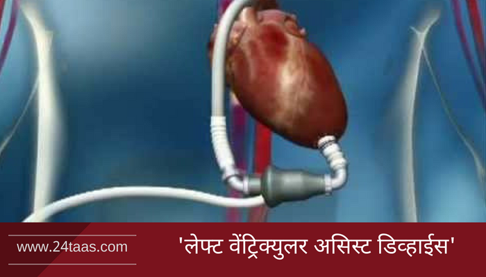 हृदय प्रत्यारोपणासाठी महाराष्ट्रात पहिल्यांदाच 'एल व्याड' हृदय प्रत्यारोपणासाठी महाराष्ट्रात पहिल्यांदाच 'एल व्याड'
