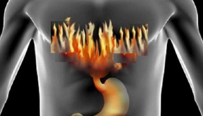 घरातील या पदार्थांमुळे अॅसिडीटीपासून सहज मुक्तता घरातील या पदार्थांमुळे अॅसिडीटीपासून सहज मुक्तता