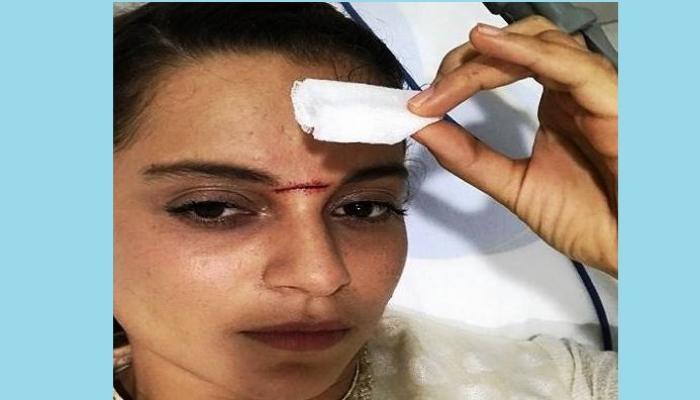 अभिनेत्री कंगना राणावतच्या डोक्याला तलवारीचा घाव अभिनेत्री कंगना राणावतच्या डोक्याला तलवारीचा घाव